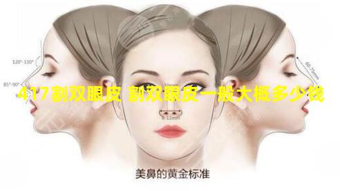 417割双眼皮 割双眼皮一般大概多少钱